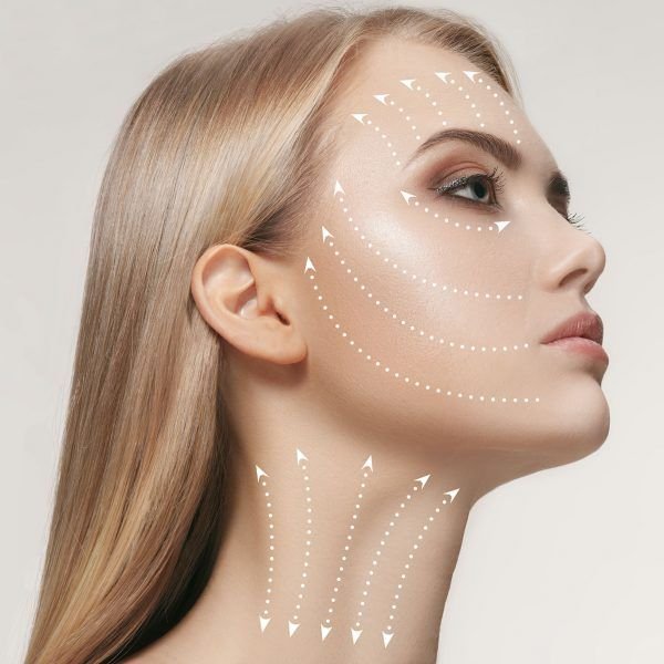 Facelift treatment