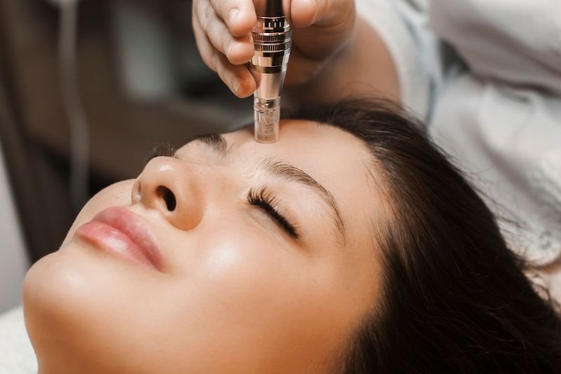 Mesotherapy treatment