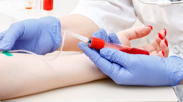 Numerous Tests Available