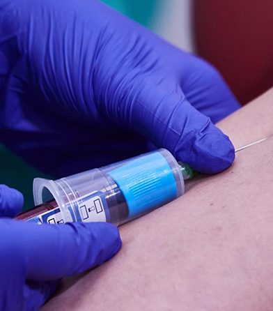 Oxidative Stress Test