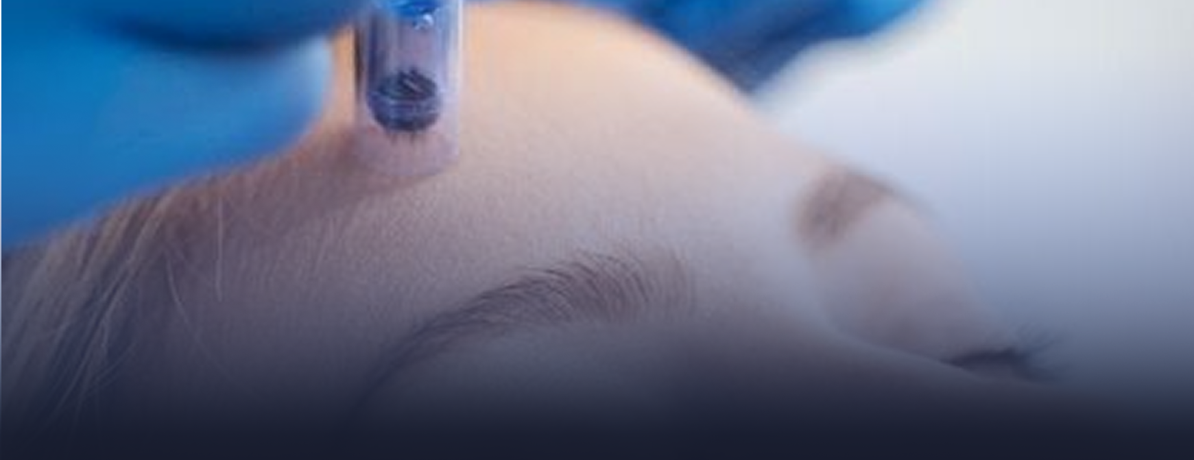 Mesotherapy