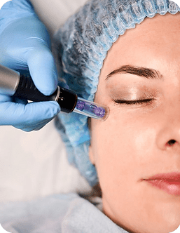 Mesotherapy