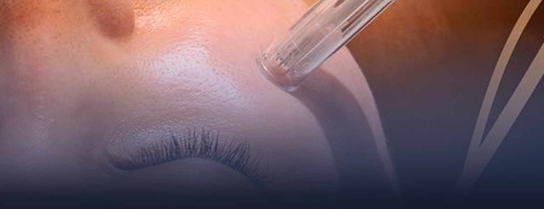 microneedlingrf-banner